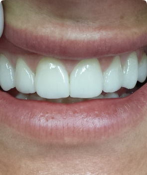 dental services