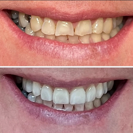 Smile Gallery
