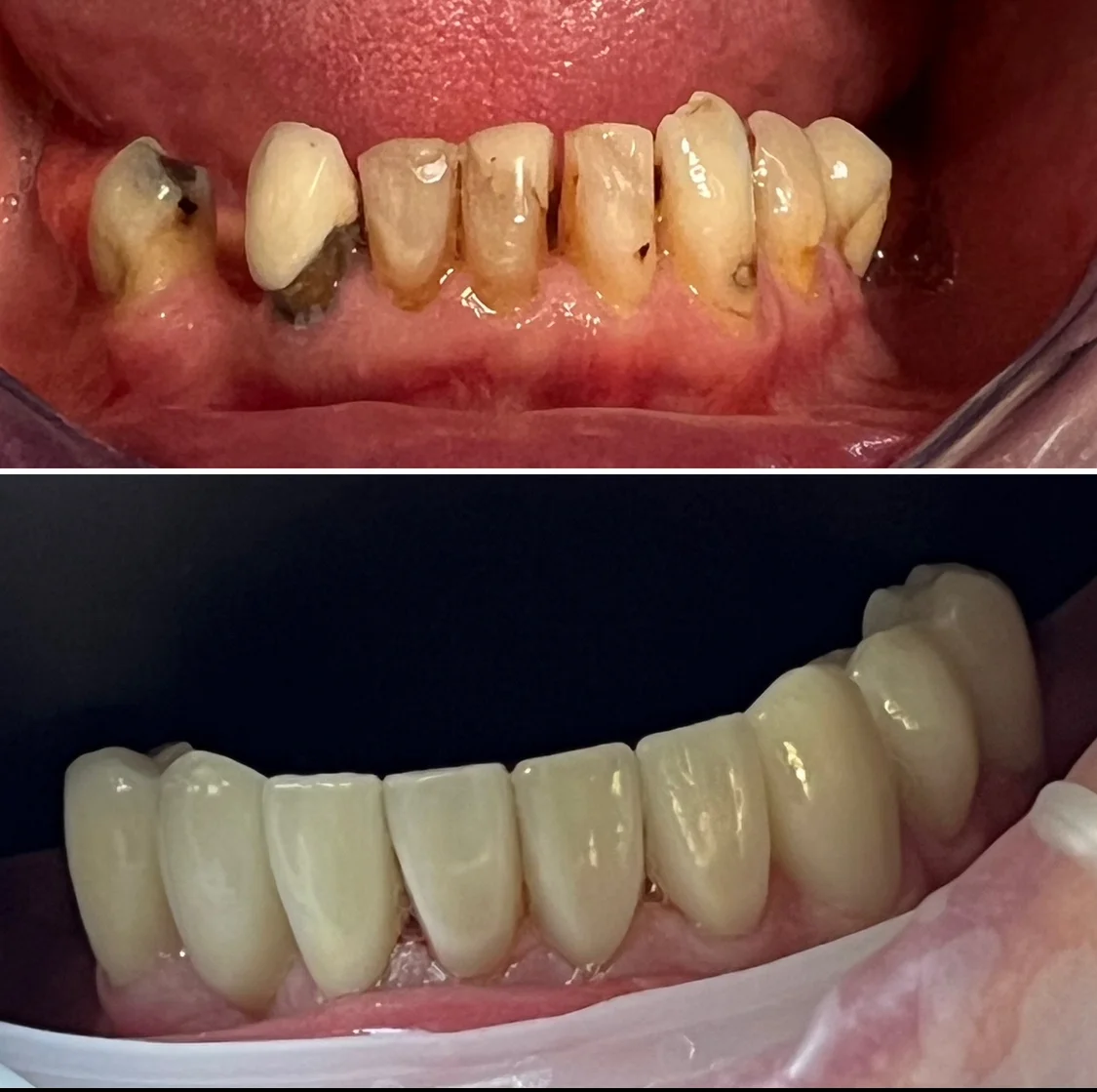 dental implants near me