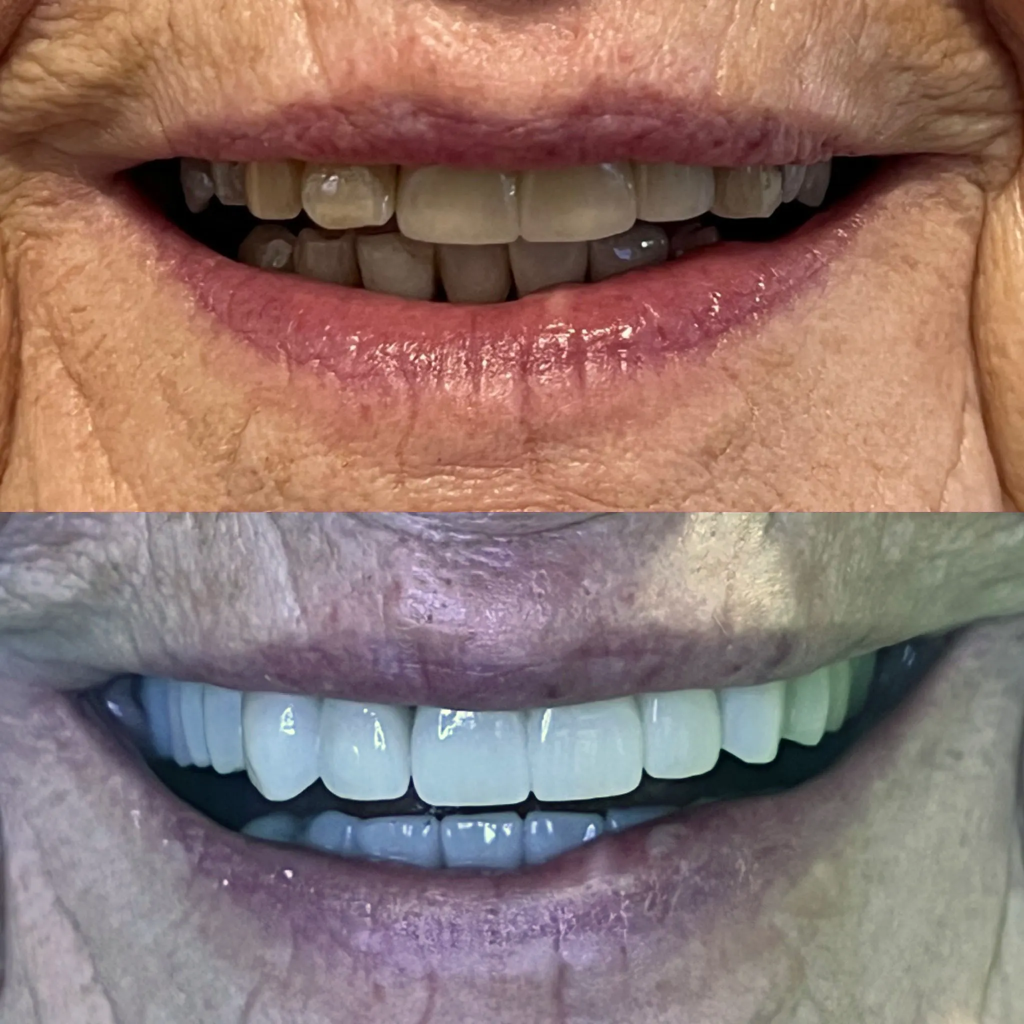 dental implants services