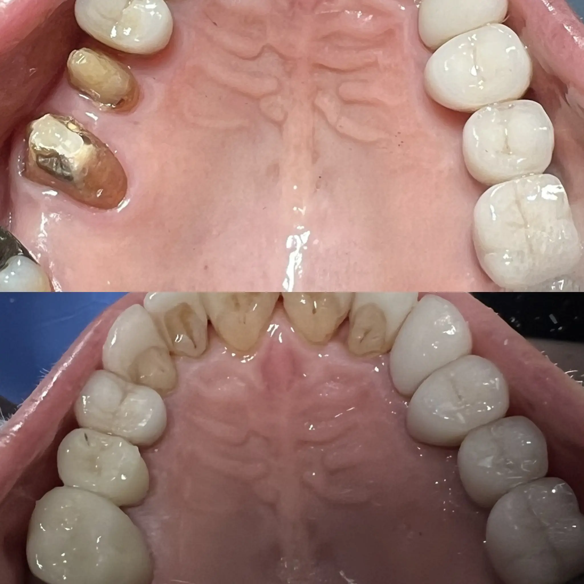 dental implants services