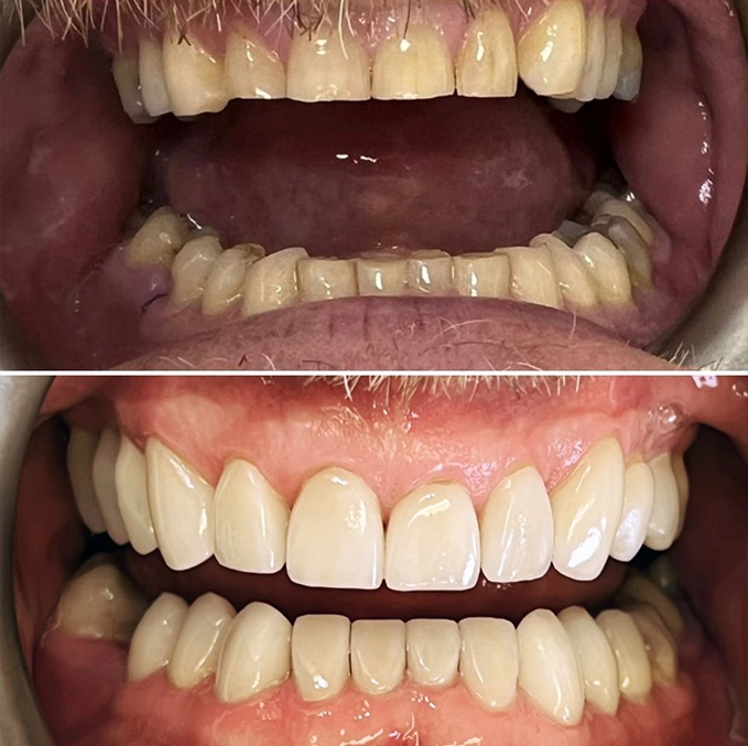 dental care services