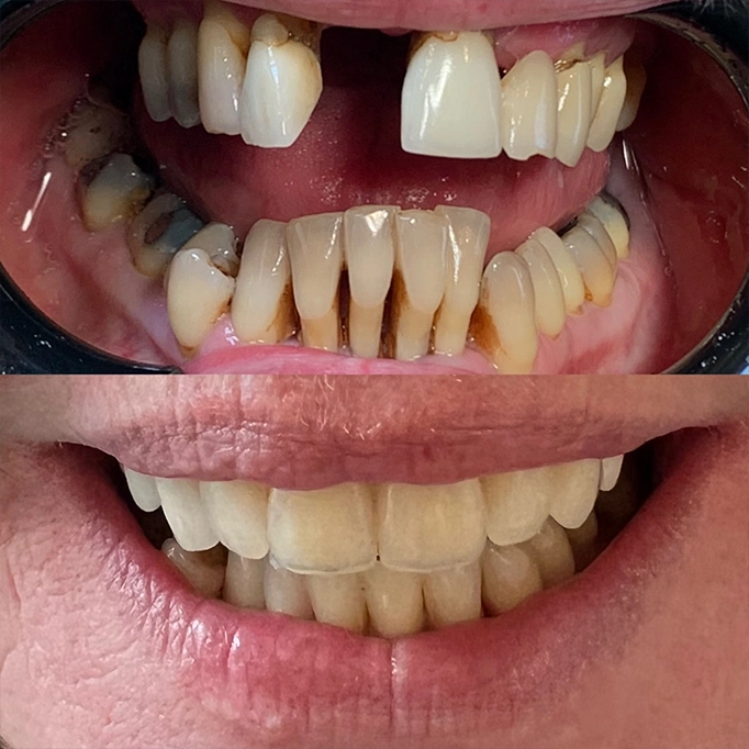 dental care